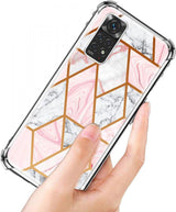 3 darab márvány tok Xiaomi Redmi Note 11/Note 11-hez, szilikon mobiltelefon tok, márvány - Outlet24
